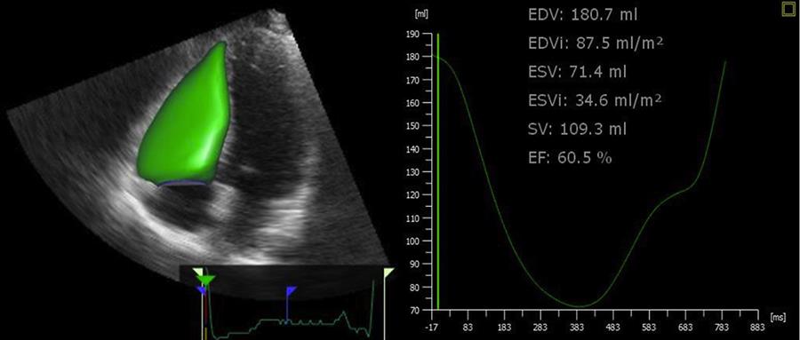 Eco 3D Machine Learning
