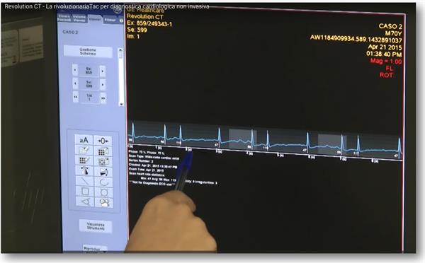 Adreini Medicina Informazione