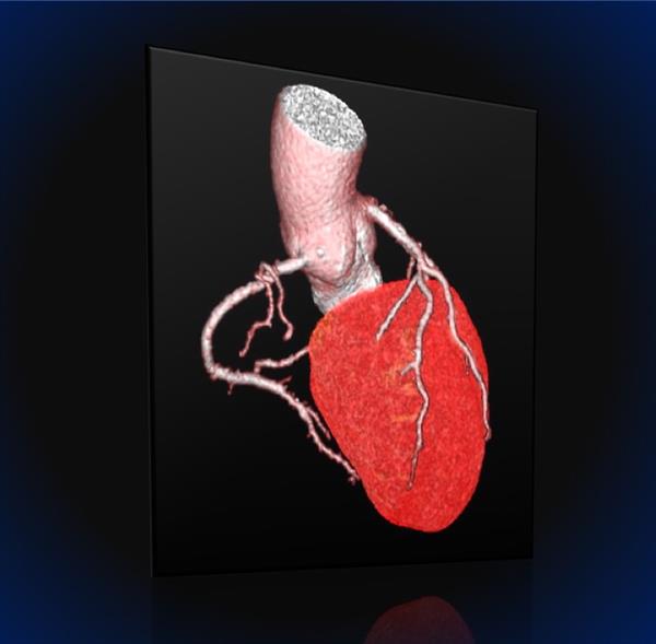 Eventi Imaging TC 3 Stretta