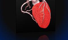 Eventi Imaging TC 3 Stretta